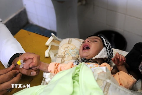  Trẻ em bị suy dinh dưỡng được điều trị tại một bệnh viện ở Sanaa, Yemen ngày 5/5. Ảnh: (Nguồn: THX/TTXVN)