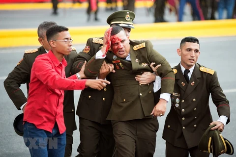 Một binh sỹ bị thương trong vụ tấn công tại Venezuela. (Ảnh: THX/TTXVN)