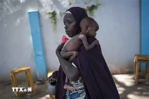 Trẻ em bị suy dinh dưỡng tại Maiduguri, Nigeria. (Nguồn: AFP/TTXVN)