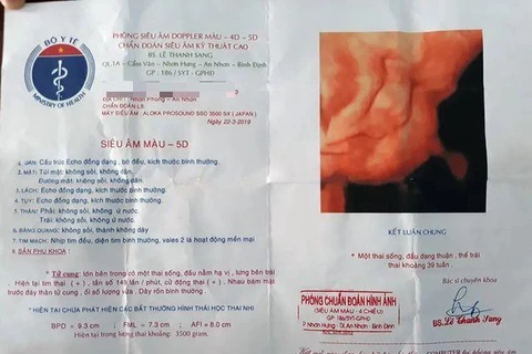 Khẩn trương xác minh trường hợp thai nhi 5,1kg tử vong tại Bình Định