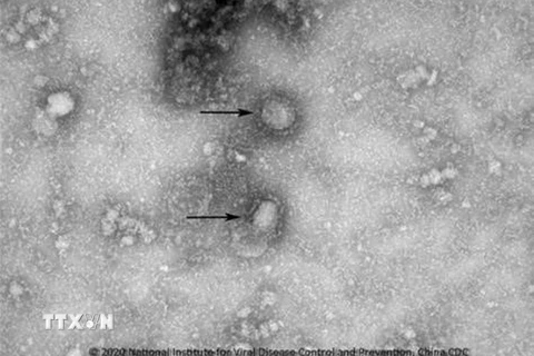 Virus corona mới, được cho là nguyên nhân gây ra dịch viêm phổi lạ tại Vũ Hán, Trung Quốc. (Ảnh: Yonhap/ TTXVN)