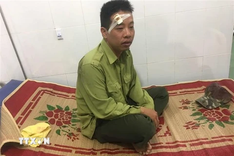 Anh Ngô Lê Nhật Tiến, Trạm phó Trạm Kiểm lâm số 7 bị đối tượng dùng gậy đánh vào vùng mặt, được điều trị tại Trung tâm Y tế huyện Ea Súp. (Ảnh: TTXVN)