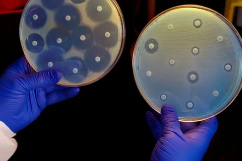 Nuôi cấy vi khuẩn thử nghiệm kháng sinh. (Nguồn: Science History Images/Alamy)