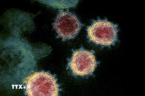 Hình ảnh virus SARS-CoV-2 được soi dưới kính hiển vi. (Ảnh: AFP/TTXVN)