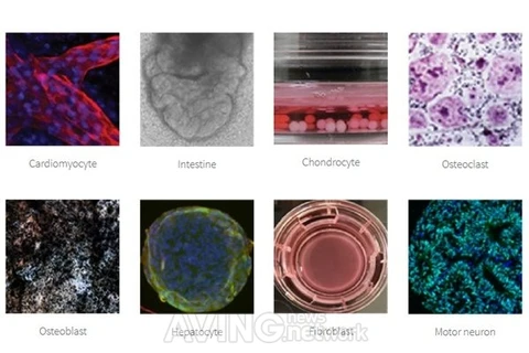 Các mô hình bệnh tật khác nhau sử dụng tế bào gốc đa năng cảm ứng. (Nguồn: Aving)