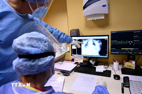 Nhân viên y tế theo dõi hình chụp X-quang phổi của một bệnh nhân COVID-19 tại bệnh viện ở Rome, Italy. (Ảnh: AFP/TTXVN)
