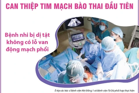 Việt Nam ghi dấu ấn mới trong kỹ thuật can thiệp tim mạch bào thai đầu tiên