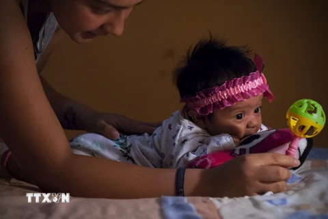Em bé bị mắc chứng đầu nhỏ tại thủ đô Quito, Ecuador. (Nguồn: THX/TTXVN)