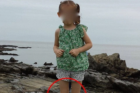 Rợn người với "đôi chân ma" trong ảnh chụp bé gái ở Nhật Bản