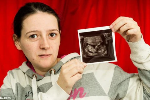 Quyết sinh con dù thai nhi chỉ có 1% cơ hội sống sót
