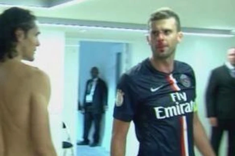 Tiền vệ PSG bị đồng hương húc vỡ mũi ngay trong đường hầm