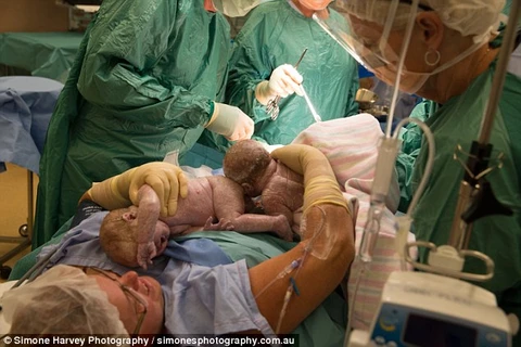 Bà mẹ 41 tuổi tự đưa tay vào ổ bụng để đón con chào đời