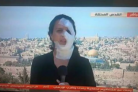 Nữ phóng viên lên hình với băng quấn đầy quanh mặt. (Nguồn: independent)