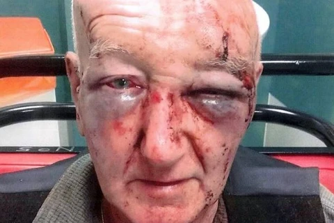 Cụ già bị đánh đập dã man. (Nguồn: manchestereveningnews.co.uk)