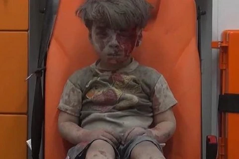 Cậu bé người Syria Omran. (Nguồn: news.com.au)
