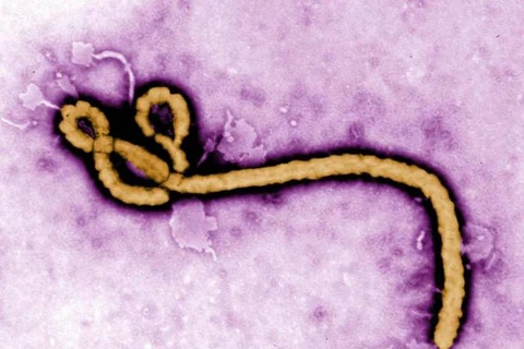 Nhật Bản sẽ nghiên cứu virus ebola. (Nguồn: Kyodo)