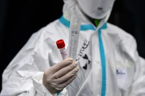 Vùng Lombardy xét nghiệm máu tìm người có kháng thể với virus SARS-CoV-2. (Nguồn: AFP)
