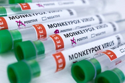 Nhật Bản tiếp tục ghi nhận thêm ca mắc bệnh đậu mùa khỉ