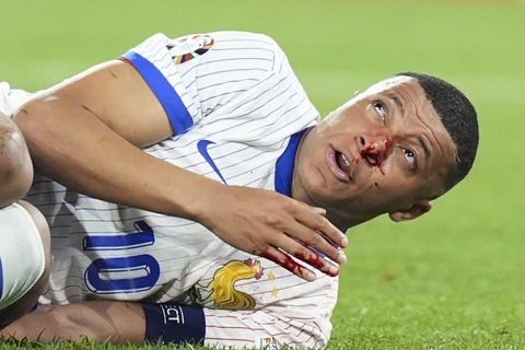 Mbappe dính chấn thương mũi trong trận Pháp thắng Áo 1-0. (Nguồn: X)