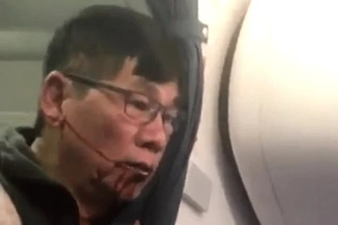 Bác sỹ gốc Việt David Dao bị kéo khỏi máy bay của United Airlines. (Nguồn: Twitter)