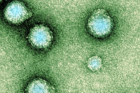 Samoa: Gần 100 người dân mắc bệnh từ một loại virus lạ