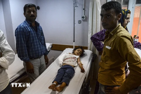 Một em bé Syria bị thương trong vụ tàn sát của phiến quân IS ở thị trấn Kobane, tại Suruc, tỉnh Sanliurfa ngày 26/6. (Nguồn: AFP/TTXVN)