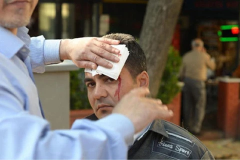Một nạn nhân bị thương sau vụ đánh bom liều chết tại Bursa. (Nguồn: Getty)