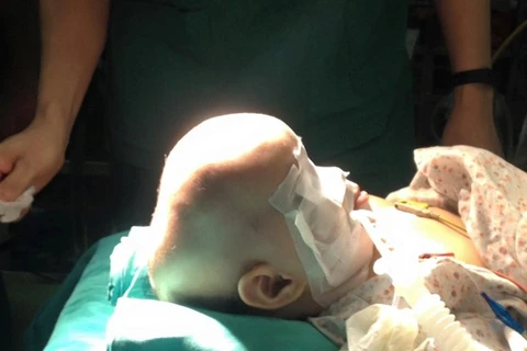 [Video] Phẫu thuật thành công bệnh nhi dị dạng sọ mặt hiếm gặp