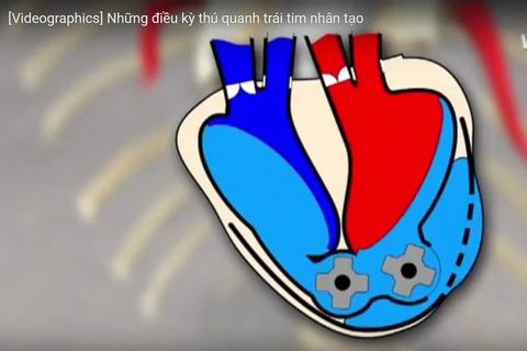 [Videographics] Những điều kỳ thú quanh trái tim nhân tạo