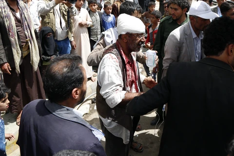 Nạn nhân bị thương tại hiện trường một vụ không kích ở Sanaa, Yemen, ngày 7/4/2019. (Ảnh: THX/TTXVN) 
