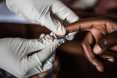 Lấy mẫu máu để xét nghiệm HIV/AIDS tại một cơ sở y tế tại Zambia. (Ảnh: TTXVN)