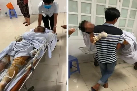 Phú Yên: Khởi tố đối tượng phóng hỏa khiến 4 người bị bỏng nặng