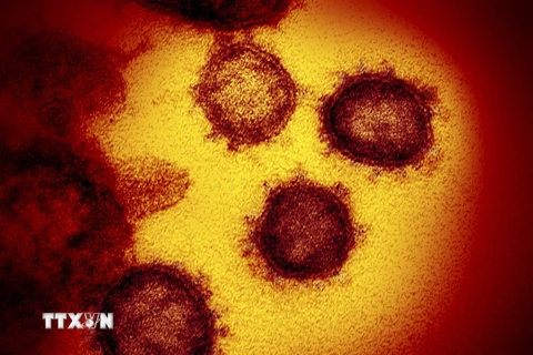 Hình ảnh dưới kính hiển vi từ viện y tế quốc gia Mỹ cung cấp cho thấy virus SARS-CoV-2 gây bệnh COVID-19 được phân lập và xuất hiện trên bề mặt tế bào của một bệnh nhân ở Mỹ. (Ảnh: AFP/TTXVN)