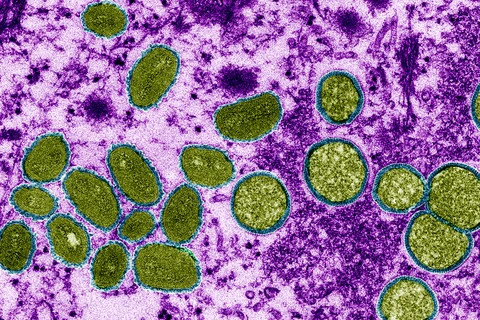 Virus đậu mùa khỉ hiển thị dưới kính hiển vi điện tử màu. (Nguồn: science.org)