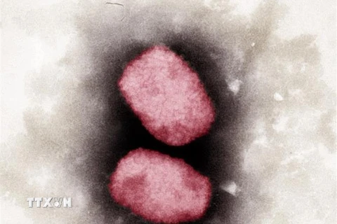Virus đậu mùa khỉ nhìn dưới kính hiển vi. (Ảnh: AFP/TTXVN)