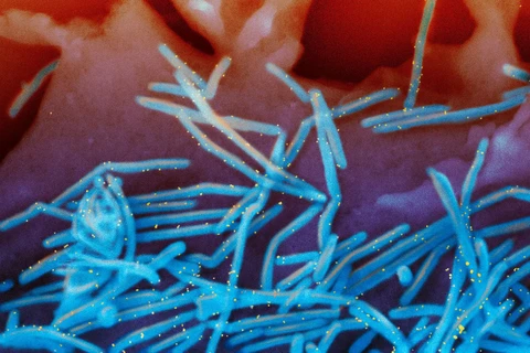Hình ảnh virus hợp bào hô hấp ở người chụp bằng kính hiển vi điện tử có màu, với virus màu xanh lam và kháng thể màu vàng, bong ra khỏi bề mặt tế bào phổi người. (Nguồn: The New York Times)