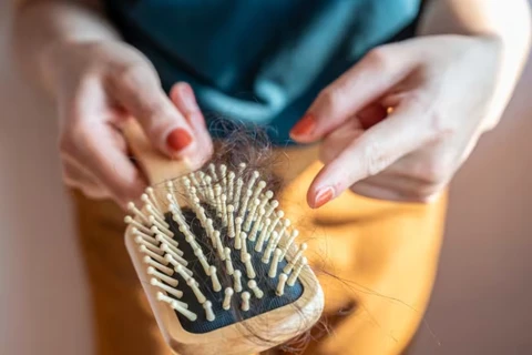 Rụng tóc bệnh lý là khi bạn bị rụng nhiều hơn 100 sợi tóc mỗi ngày. (Nguồn: Cloudinary)