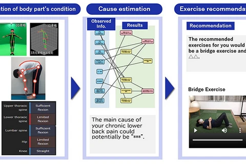 Công nghệ AI hỗ trợ cải thiện chứng đau lưng mãn tính. (Nguồn: NEC)