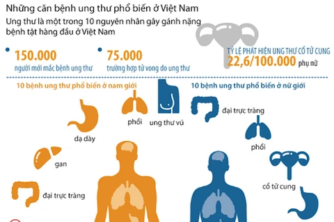 [Infographics] Những căn bệnh ung thư phổ biến ở Việt Nam