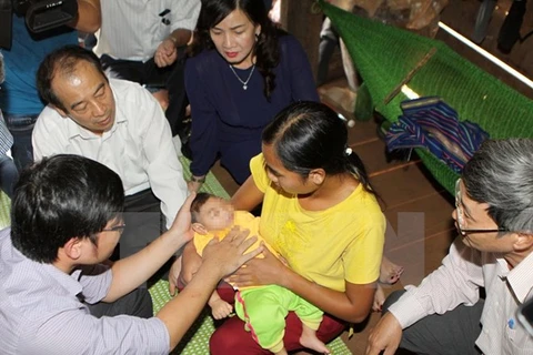 Đoàn công tác của Bộ Y tế thăm khám cho bệnh nhi bị dị tật đầu nhỏ vào ngày 18/10. (Ảnh: Dương Giang/TTXVN)