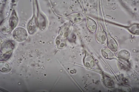 Henneguya salminicola dưới kính hiển vi. (Nguồn: https: timesofisrael.com)