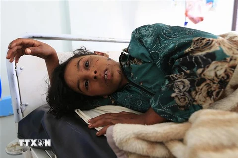 Một em nhỏ bị thương sau cuộc không kích của liên minh do Saudi Arabia dẫn đầu tại tỉnh al-Jawf, miền Bắc Yemen ngày 16/7/2020. (Nguồn: AFP/TTXVN)