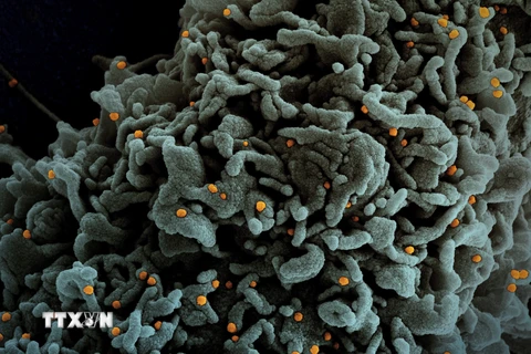 Hình ảnh do Viện nghiên cứu bệnh truyền nhiễm và dị ứng quốc gia Mỹ cung cấp cho thấy hình ảnh dưới kính hiển vi một tế bào (màu xanh) của bệnh nhân COVID-19 bị nhiễm biến thể B.1.1.7 của virus SARS-CoV-2 (màu vàng). (Ảnh: AFP/TTXVN) 