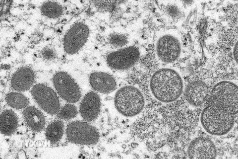 Hình ảnh dưới kính hiển vi cho thấy virus đậu mùa khỉ trong mẫu bệnh phẩm của một bệnh nhân. (Nguồn: Reuters/TTXVN)