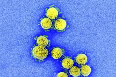 Hình ảnh từ kính hiển vi do Viện Y tế quốc gia Mỹ cung cấp cho thấy virus SARS-CoV-2 trong mẫu bệnh phẩm của bệnh nhân mắc COVID-19 ở Mỹ. (Ảnh: AFP/TTXVN) 