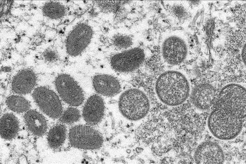 Hình ảnh virus đậu mùa khỉ dưới kính hiển vi điện tử. (Nguồn: AFP/TTXVN)