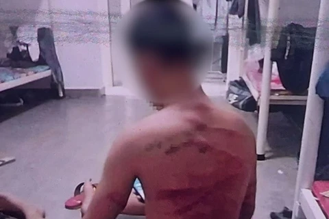 Một thanh niên bị tra tấn dã man khi nghe lời dụ dỗ qua Campuchia làm việc với mức thu nhập khủng. (Ảnh cắt từ clip/laodong.com.vn) 