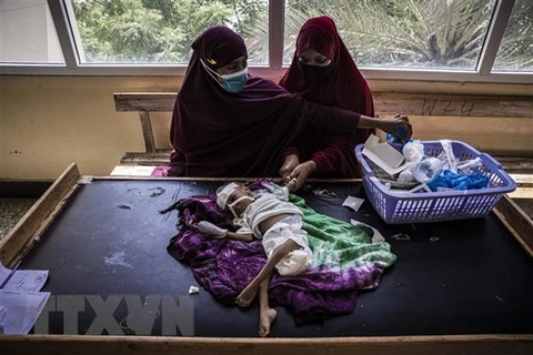 Nhân viên y tế điều trị cho em nhỏ bị suy dinh dưỡng tại bệnh viện ở Mogadishu, Somalia. (Ảnh: AFP/TTXVN) 