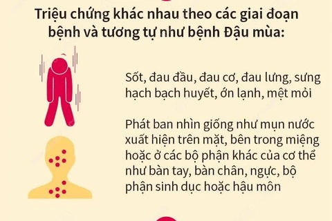 Bệnh Đậu mùa Khỉ: Triệu chứng và các biện pháp phòng bệnh