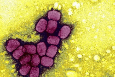 Phát hiện mẫu virus bệnh đậu mùa bị cất giữ trái phép tại Mỹ